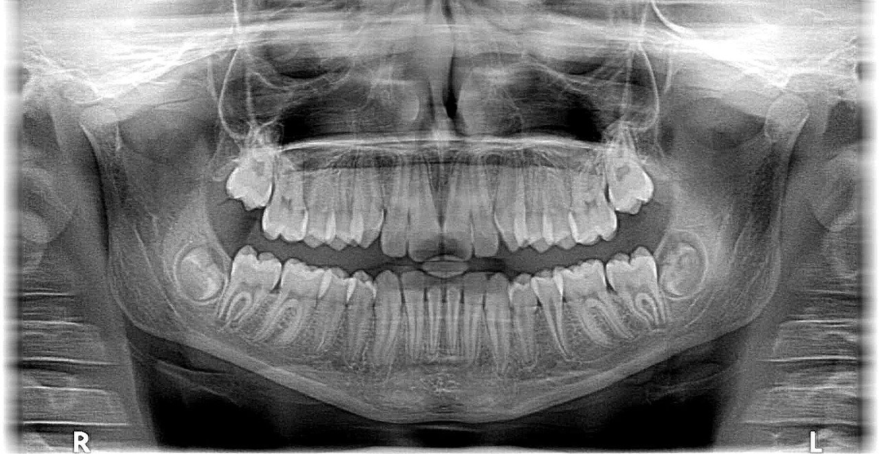 Choosing Dentist Coral Springs: Care and Services Guide
