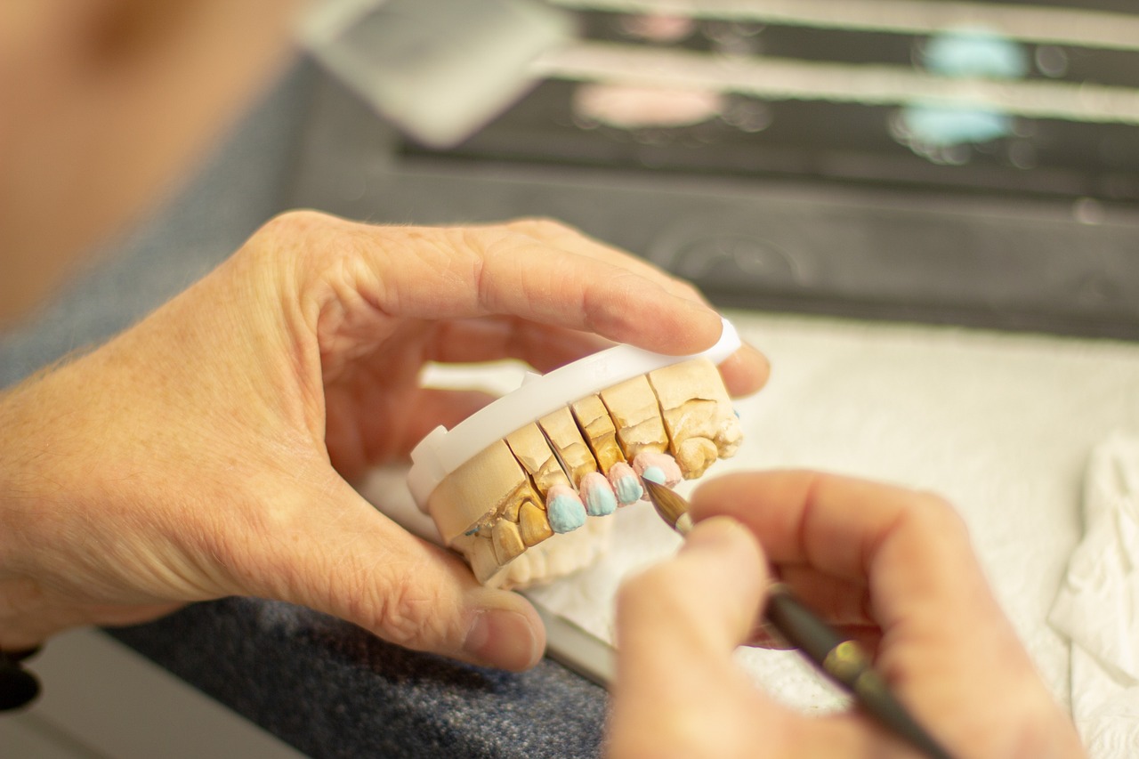 Dental Veneers Coral Springs