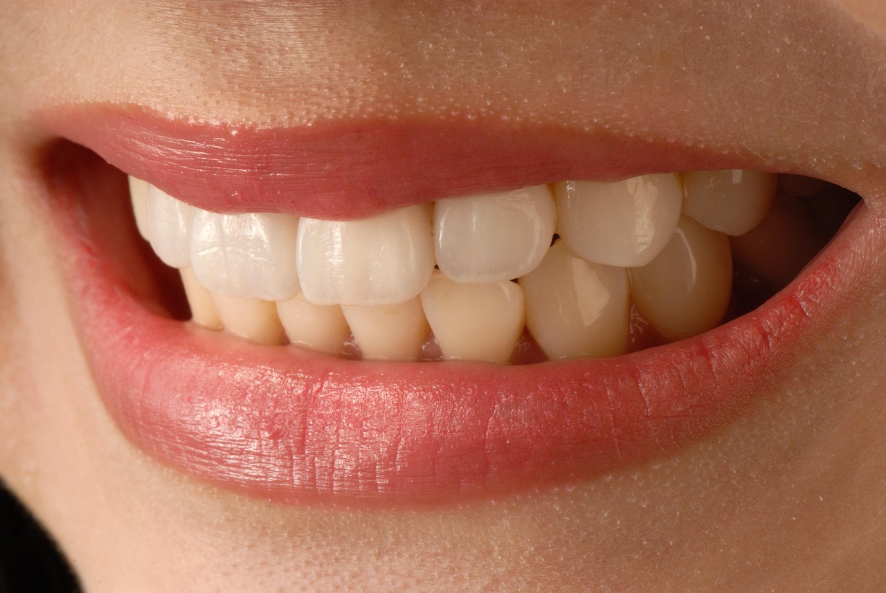 Transform Your Smile: Dental Veneers Coral Springs Guide